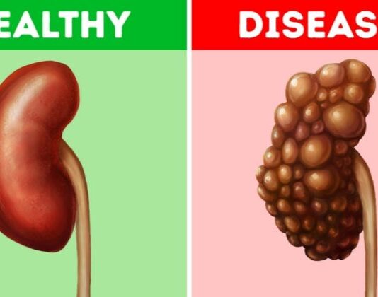 5 Common Habits That Could-Be-Damaging Your Kidneys