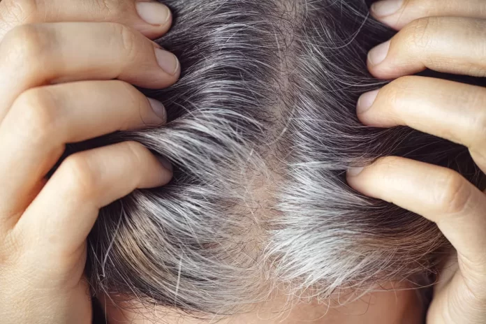 Visual representation of the stress-gray hair connection, with a worried person and strands of gray hair emerging.