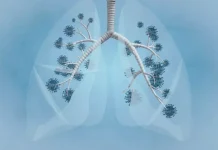 A helpful infographic about pneumonia awareness shows signs, prevention strategies, and FAQs to keep your lungs healthy.