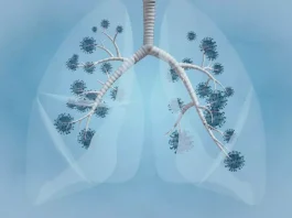 A helpful infographic about pneumonia awareness shows signs, prevention strategies, and FAQs to keep your lungs healthy.