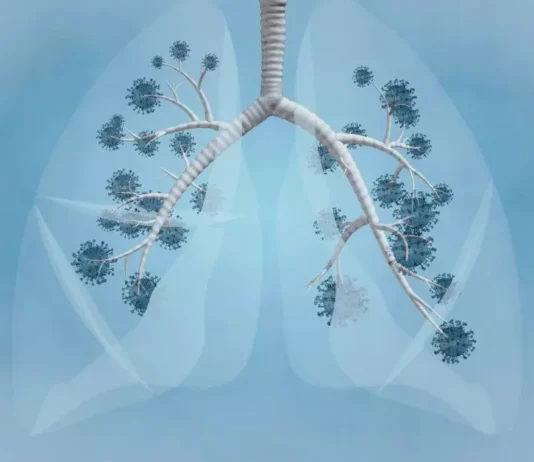 A helpful infographic about pneumonia awareness shows signs, prevention strategies, and FAQs to keep your lungs healthy.