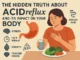 Infographic of acid reflux effects on the body, with lifestyle tips like mindful eating, hydration, and stress management.